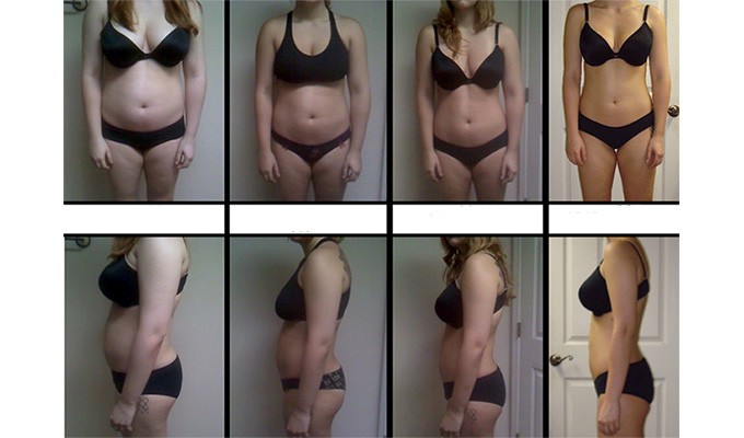 Body Slimming Treatment Before and After