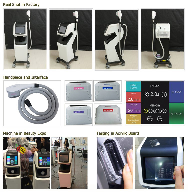 Korea Ultrasound hifu beauty machine Detail