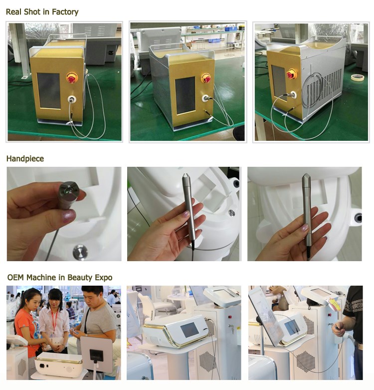980nm Laser Machine Details 980nm Laser Machine Details