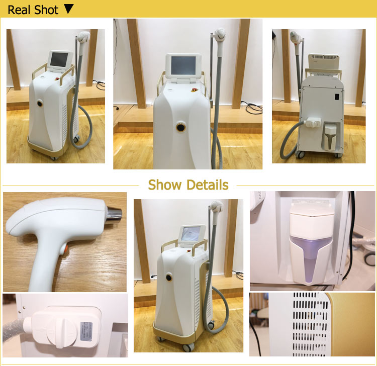 Salon used 808nm laser diode machine for permanent body and facial hair removal 