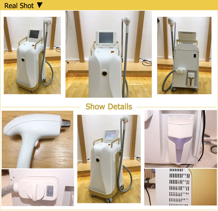 Salon used 808nm laser diode machine for permanent body and facial hair removal