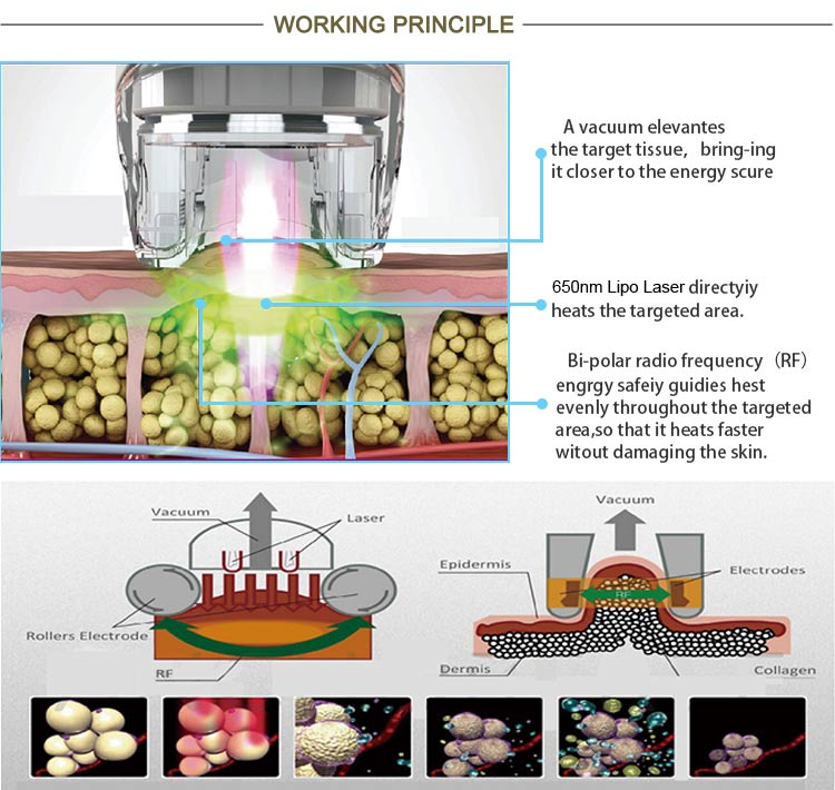 working principle of velashape slimming machine