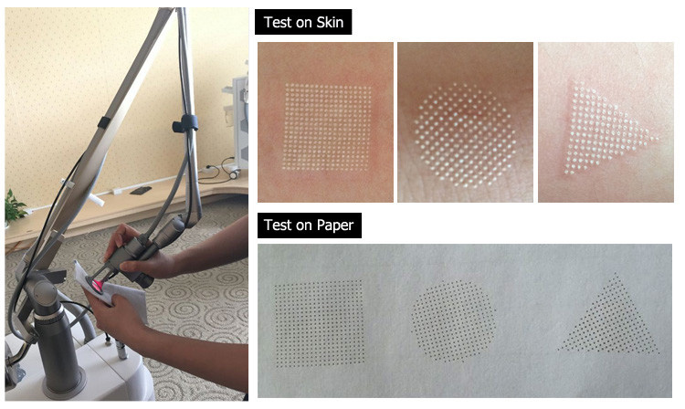 Fractional CO2 Laser System