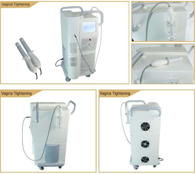 RF Vaginal Tightening Machine Details RF Vaginal Tightening Machine Details