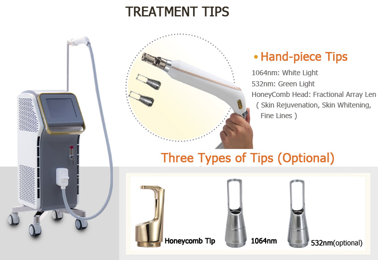 lazer tattoo removal equipment