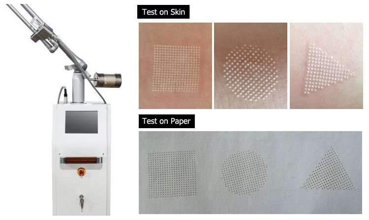 Vaginal tightening fractional co2 laser machine