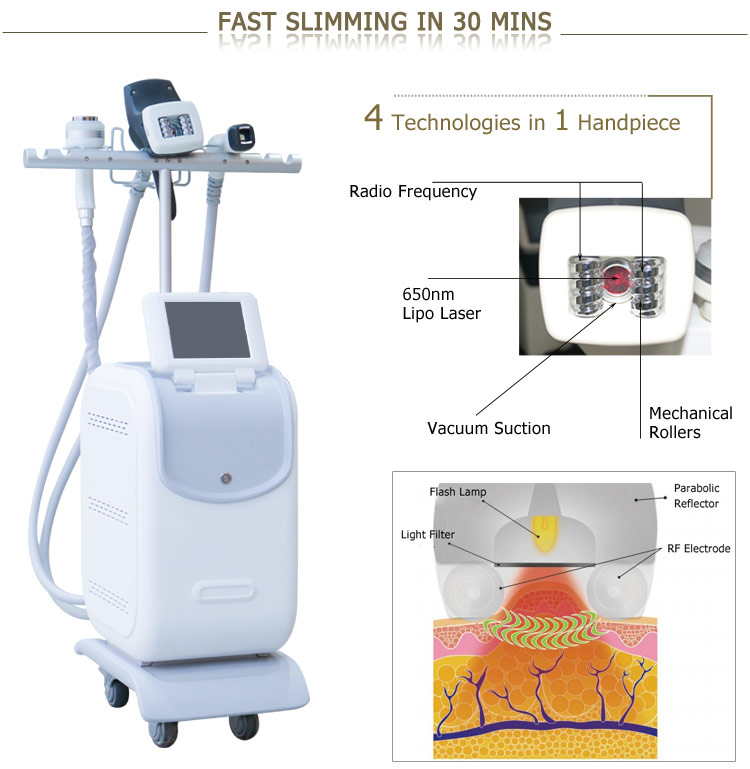 velashape body slimming, weight loss, body shape