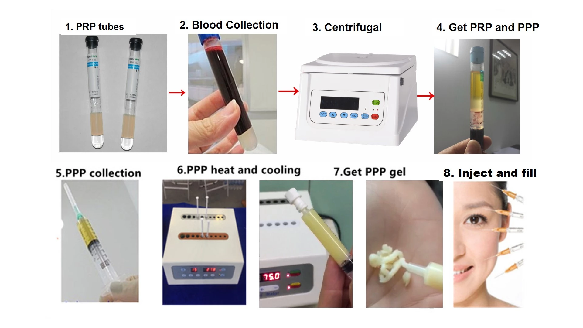 Plasama Bio-filler gel maker or PPP gel maker or plasma filler maker similar to Fillex, facial filler gel TDD-4MC