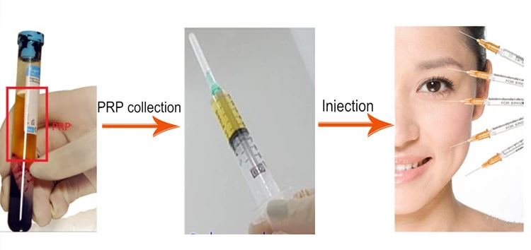 Medifuge small size PRP A-PRF PGF CGF clinic medical centrifuge hospital separte machine analysis blood plasma centrifuge