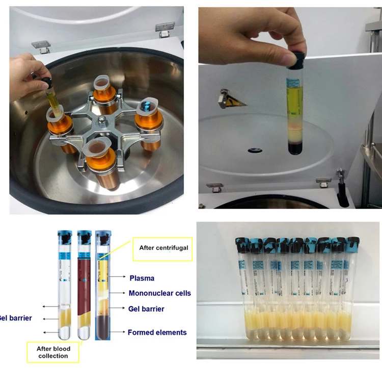 PRP centrifuge for YES DR. 3E SW-PRP Regenlab PRP tube TUbex PRO PRP Arthrex PRP Neogenesis PRP tubes