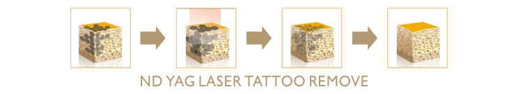 ND Yag Laser Principle ND Yag Laser Principle