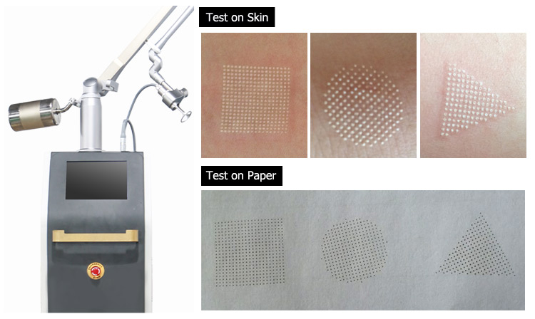 skin resurfacing Fractional Co2 Laser Equipment