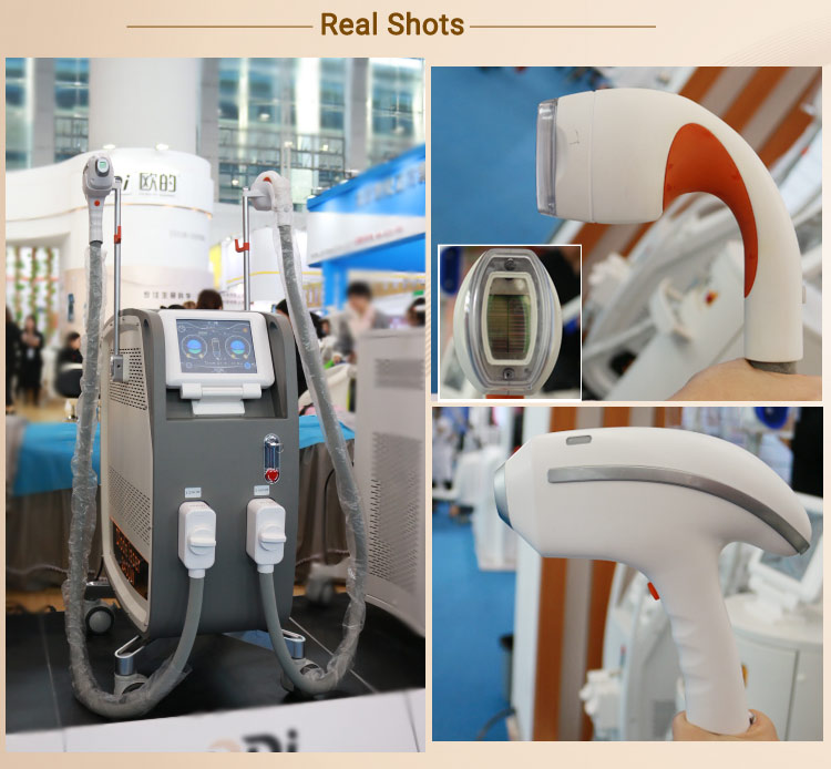 808nm diode laser hair removal machine