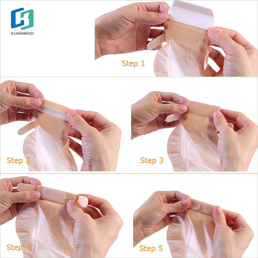 Soft hydrocolloid baseplate colostomy bag Soft hydrocolloid baseplate colostomy bag