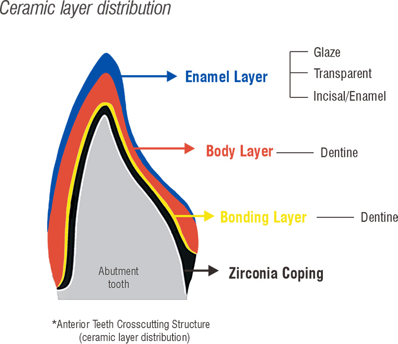 Dental Porcelain Powder for Ceramics layer