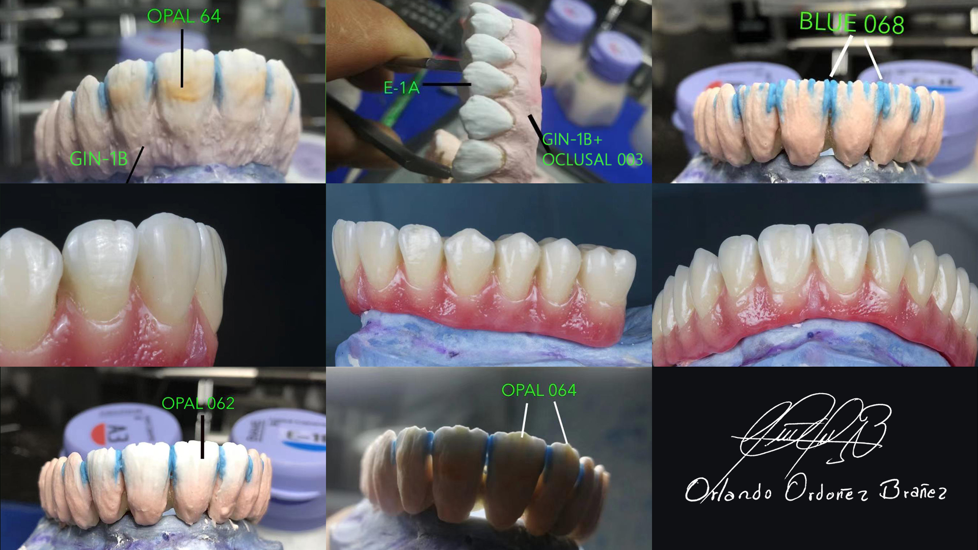 dental lab porcelain ceramic effect luster dental lab porcelain ceramic effect luster