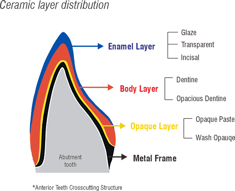 Dental Porcelain Powder for Ceramics layer