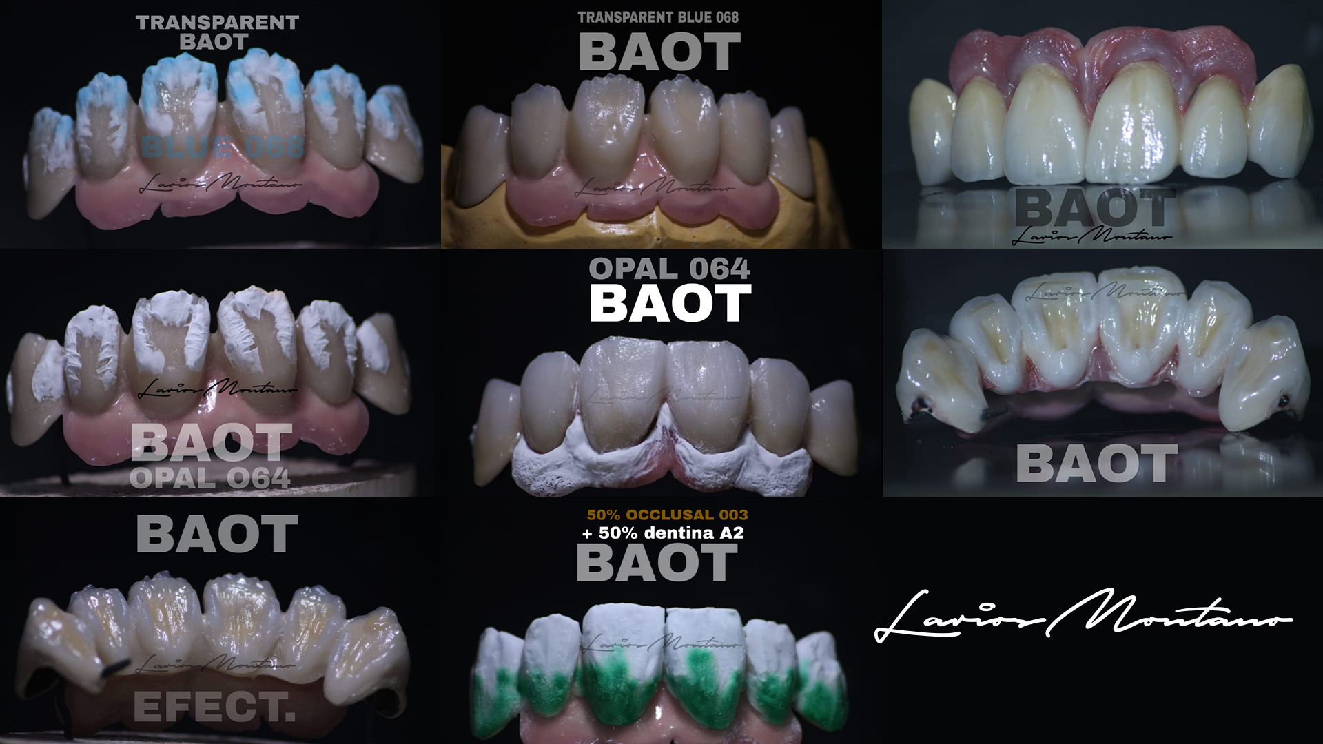 Dental Porcelain Powder for Effect Opal 3