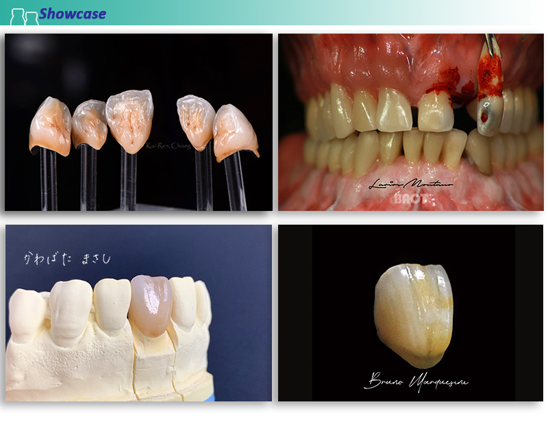 Dental Lab Material Porcelain Powder Showcase