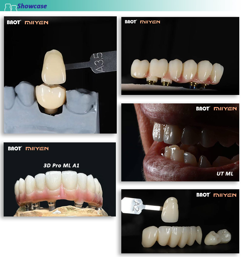 Dental Lab Material Zirconia Block showcase Dental Lab Material Zirconia Block showcase
